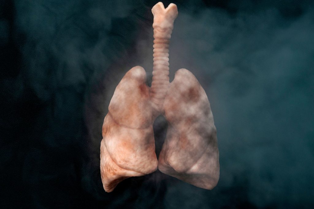 lungs damaged from the aerosol of vapes